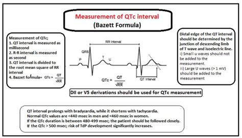 bazzet|Calculate corrected QT interval (QTc interval)